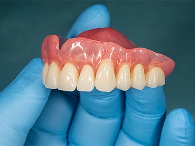 A close-up of a gloved hand holding an upper denture